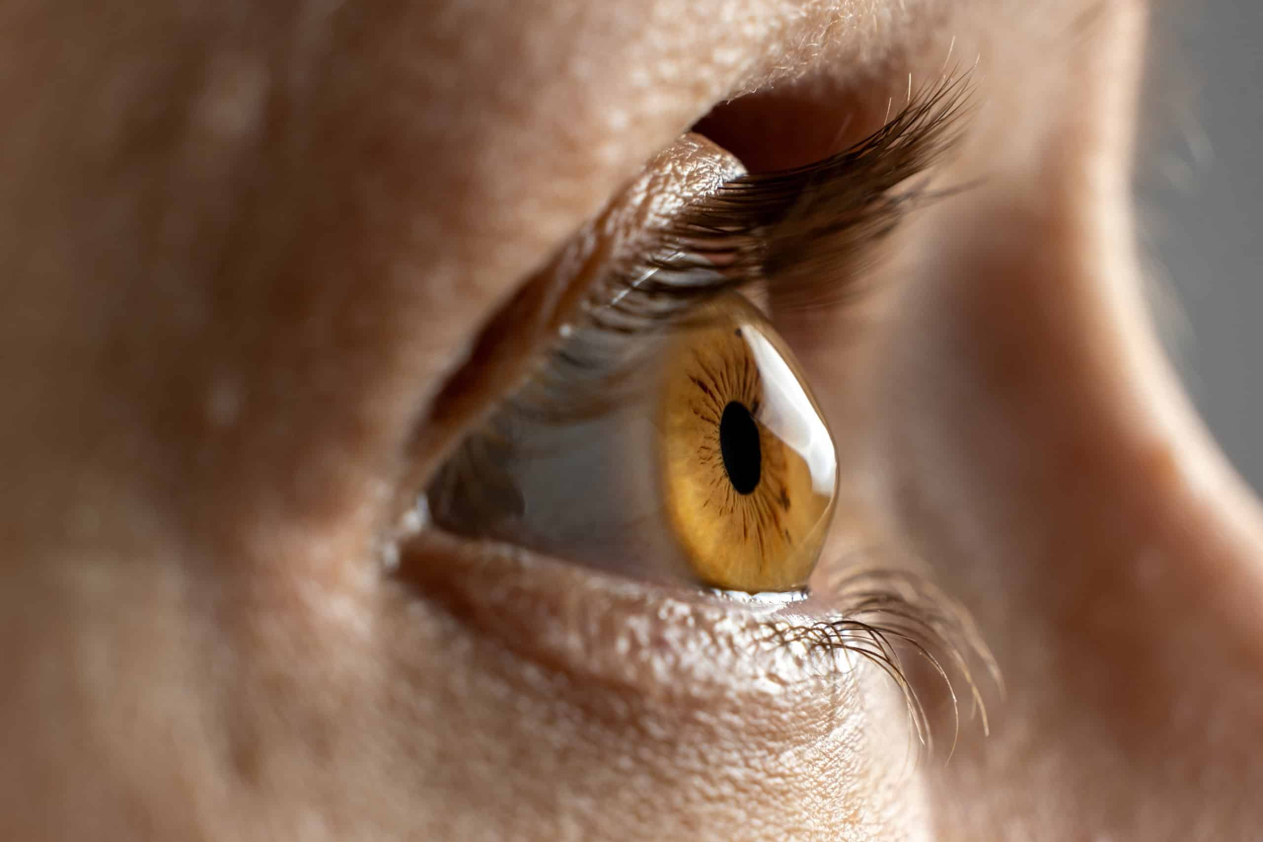 Doença autoimune pode fazer os olhos saltarem e provocar perda da visão