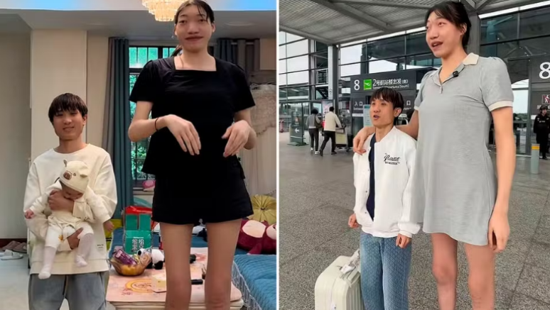 Influencer chinesa, de 2m18, morre aos 26 anos após complicações de saúde