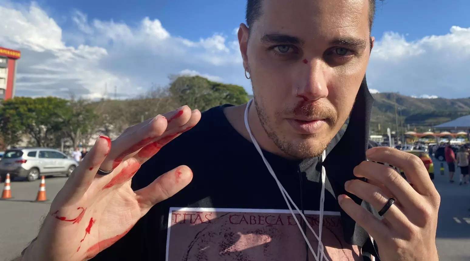 Leandro Matozo foi atacado h&aacute; 5 anos, quando cobria a programa&ccedil;&atilde;o no Santu&aacute;rio de Aparecida