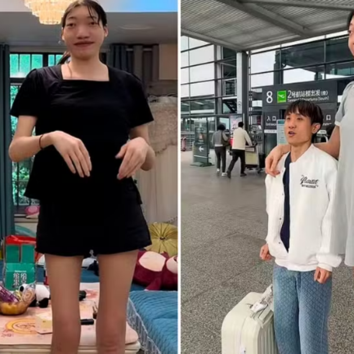 Influencer chinesa, de 2m18, morre aos 26 anos após complicações de saúde