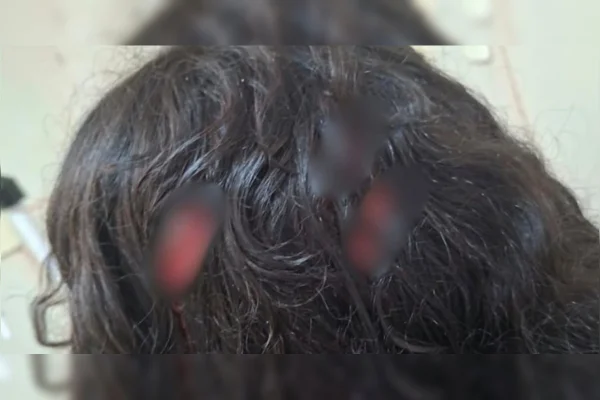 Menina de 12 anos é esfaqueada em sala de aula de escola particular