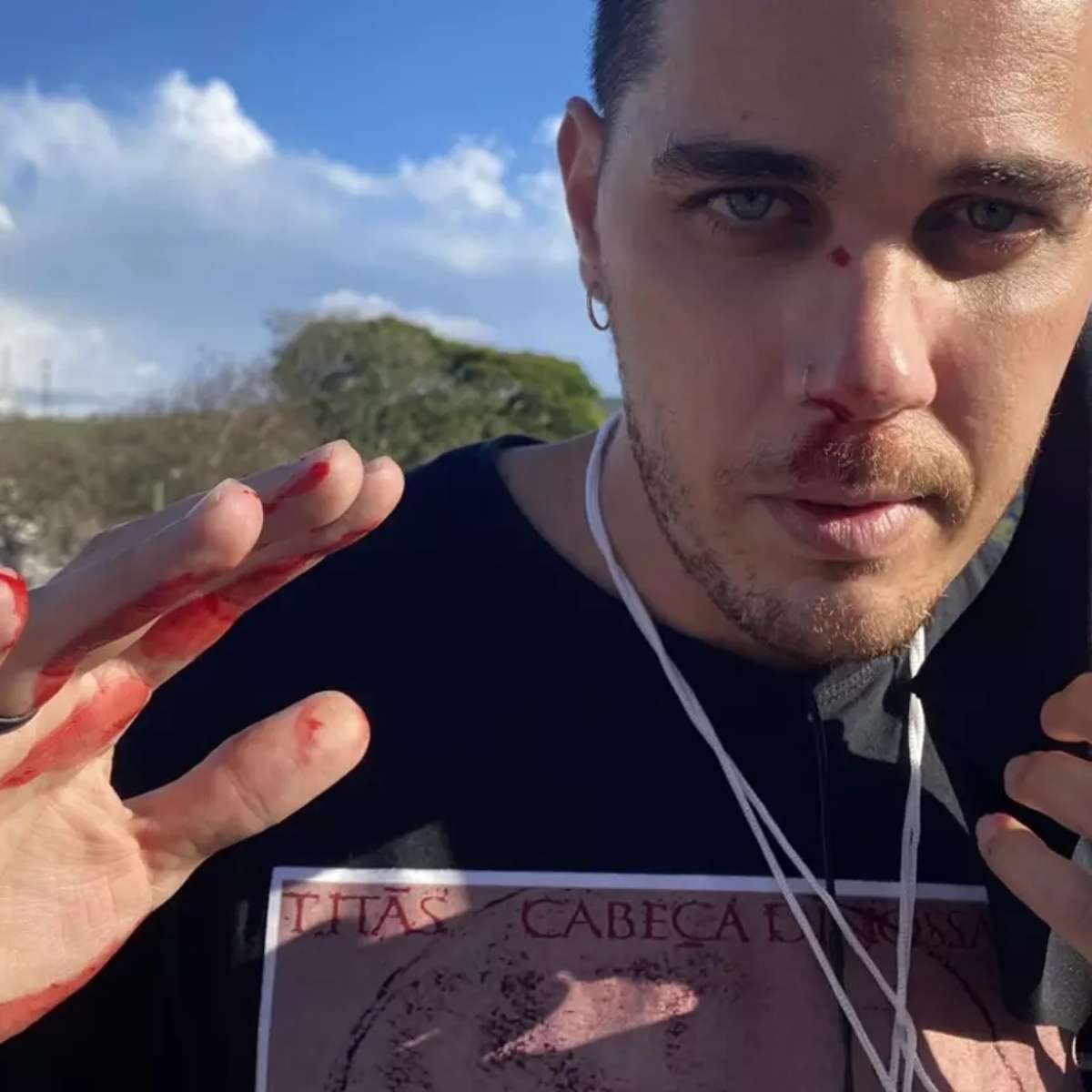 Cinegrafista da Globo agredido por bolsonarista em Aparecida no dia de Nossa Senhora desabafa: “A gente está cercado de gente ruim”