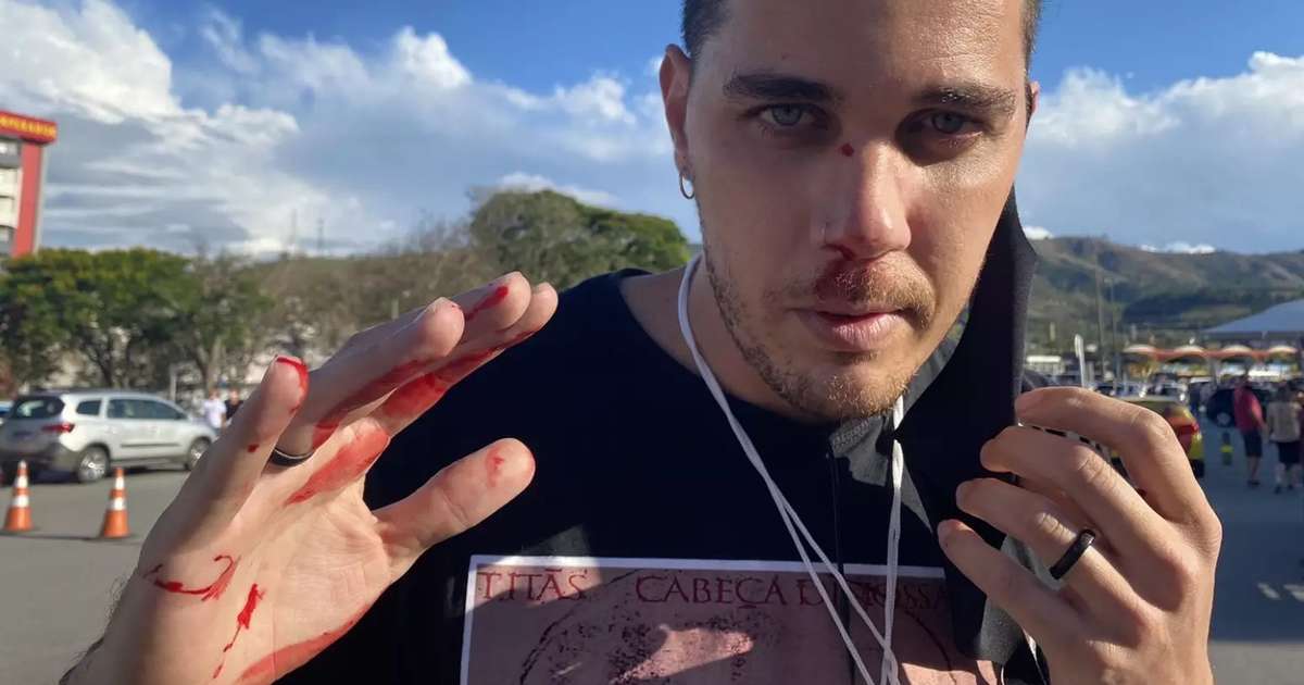Cinegrafista da Globo agredido por bolsonarista em Aparecida no dia de Nossa Senhora desabafa: “A gente está cercado de gente ruim”