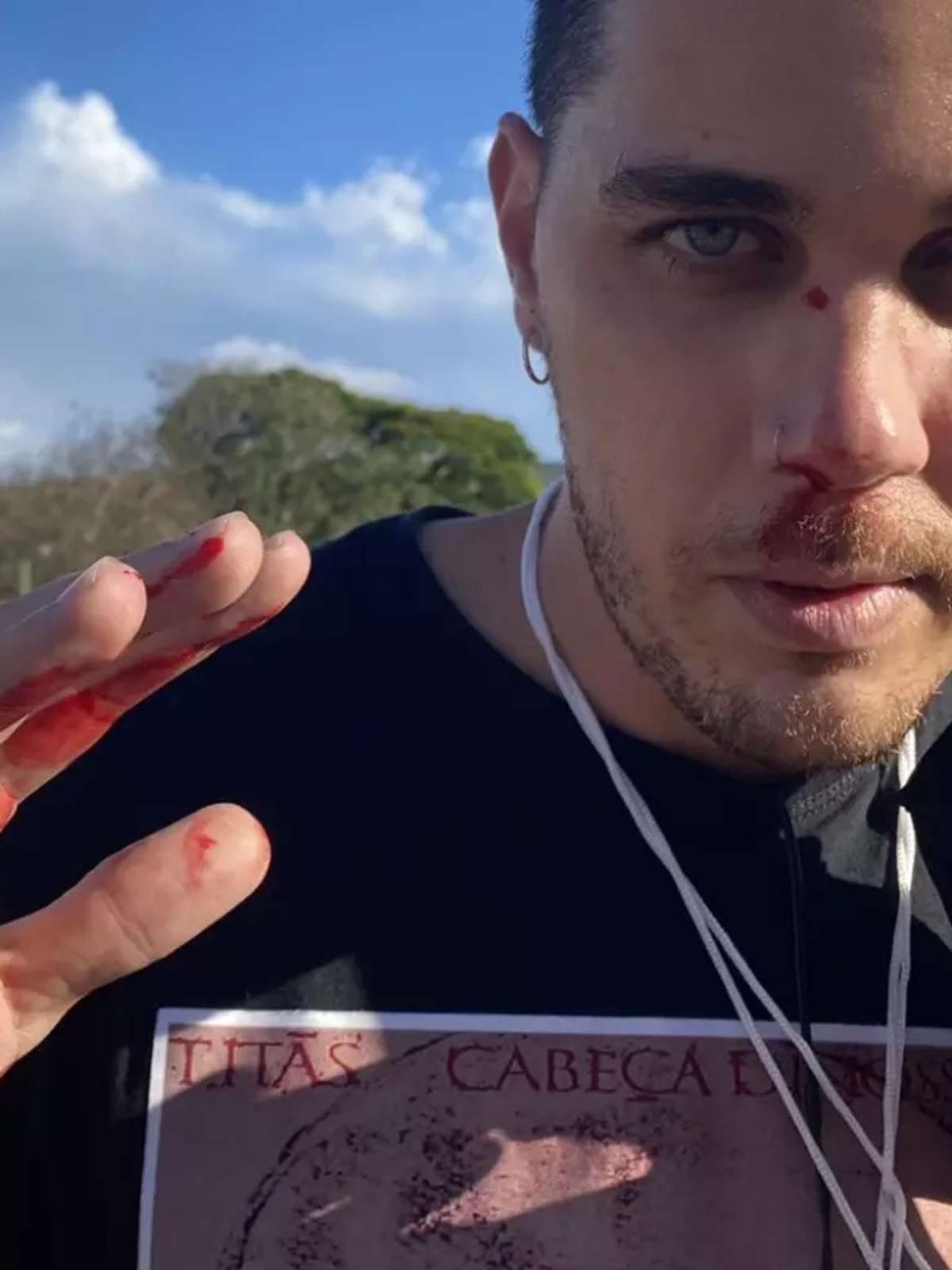 Cinegrafista da Globo agredido por bolsonarista em Aparecida no dia de Nossa Senhora desabafa: “A gente está cercado de gente ruim”