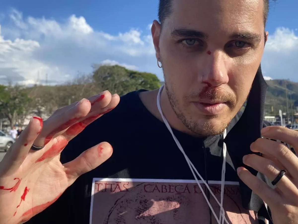 Cinegrafista da Globo agredido por bolsonarista em Aparecida no dia de Nossa Senhora desabafa: “A gente está cercado de gente ruim”